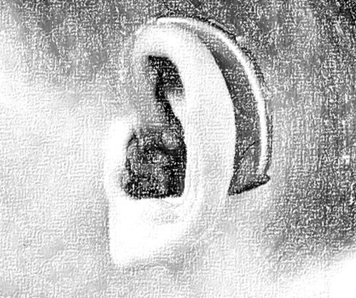 Hörgerät